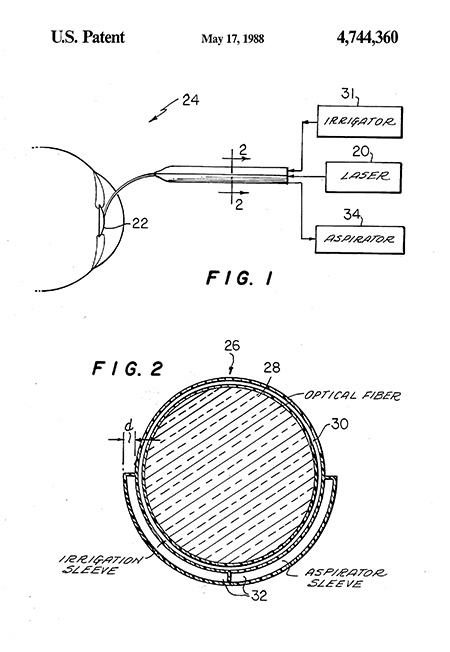 Laserphaco Probe Patent Drawing
